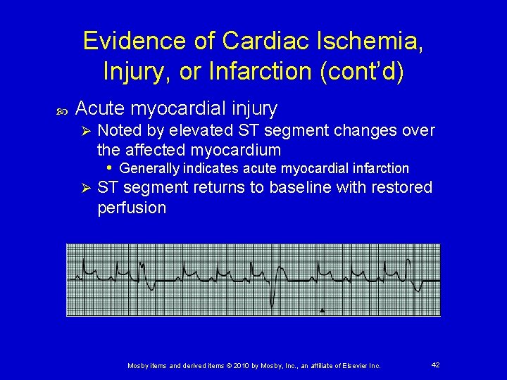 Evidence of Cardiac Ischemia, Injury, or Infarction (cont’d) Acute myocardial injury Noted by elevated