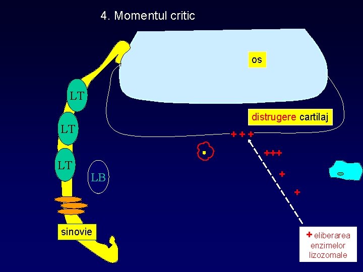 4. Momentul critic os LT distrugere cartilaj LT LT +++ LB + + sinovie