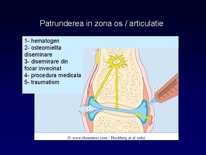 Patrunderea in zona os / articulatie 1 - hematogen 2 - osteomielita diseminare 3