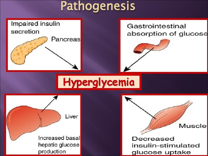 Pathogenesis Hyperglycemia 