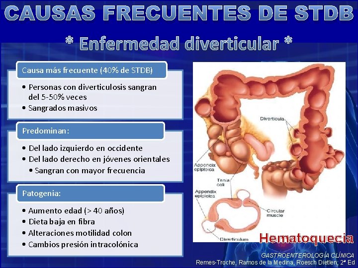 CAUSAS FRECUENTES DE STDB * Enfermedad diverticular * Causa más frecuente (40% de STDB)