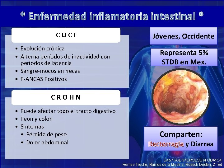 * Enfermedad inflamatoria intestinal * CUCI • Evolución crónica • Alterna períodos de inactividad