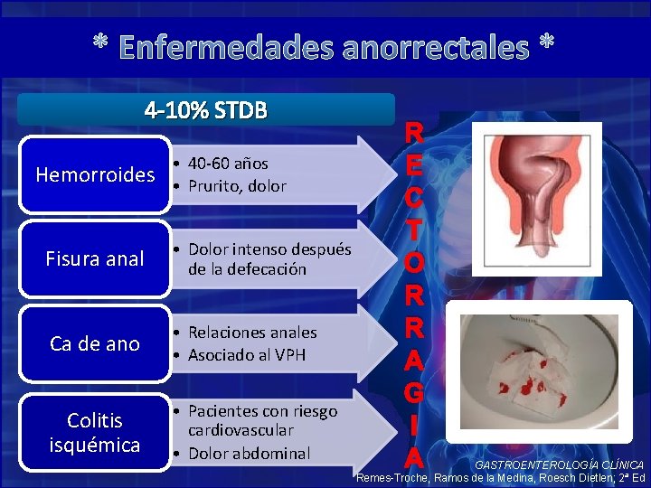 * Enfermedades anorrectales * 4 -10% STDB Hemorroides • 40 -60 años • Prurito,