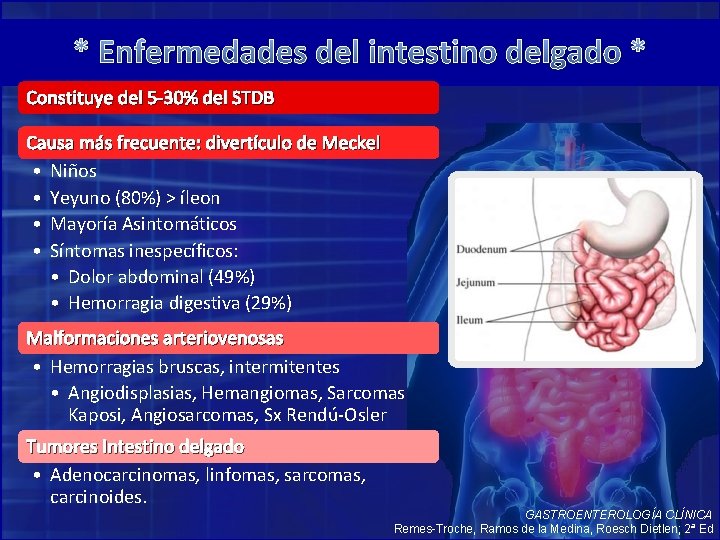 * Enfermedades del intestino delgado * Constituye del 5 -30% del STDB Causa más