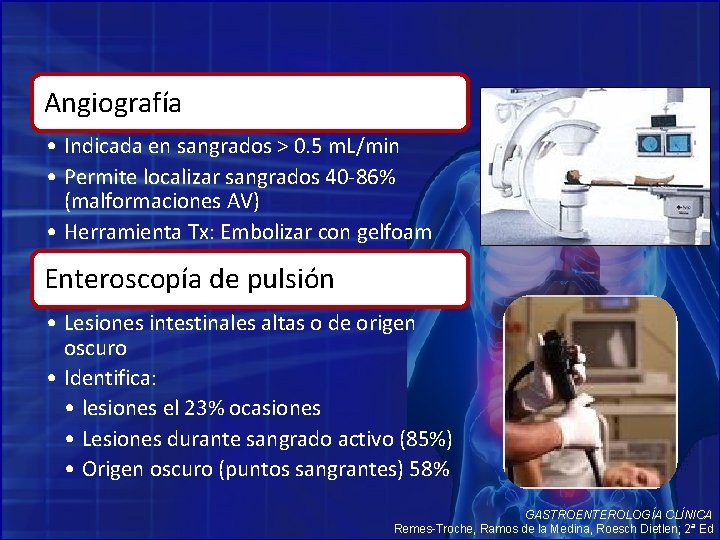 Angiografía • Indicada en sangrados > 0. 5 m. L/min • Permite localizar sangrados