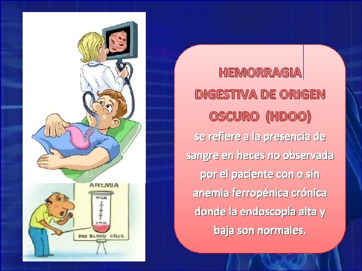HEMORRAGIA DIGESTIVA DE ORIGEN OSCURO (HDOO) se refiere a la presencia de sangre en