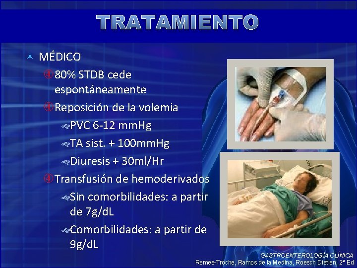 TRATAMIENTO MÉDICO 80% STDB cede espontáneamente Reposición de la volemia PVC 6 -12 mm.