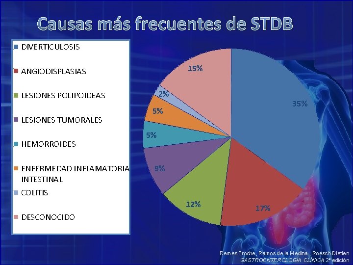 Causas más frecuentes de STDB DIVERTICULOSIS 15% ANGIODISPLASIAS 2% LESIONES POLIPOIDEAS LESIONES TUMORALES HEMORROIDES