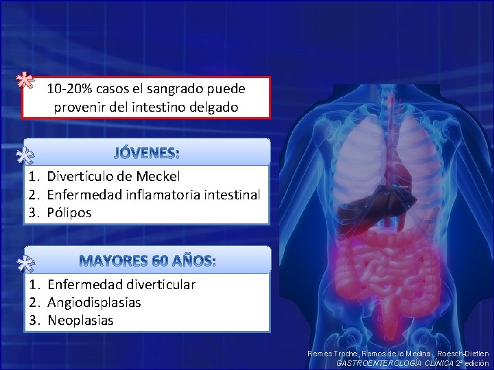 * 10 -20% casos el sangrado puede provenir del intestino delgado * 1. Divertículo