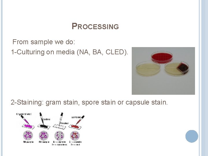 PROCESSING From sample we do: 1 -Culturing on media (NA, BA, CLED). 2 -Staining: