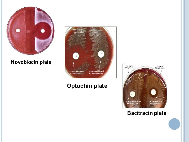 Novobiocin plate Optochin plate Bacitracin plate 