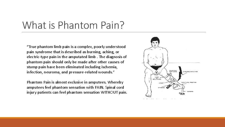 What is Phantom Pain? “True phantom limb pain is a complex, poorly understood pain