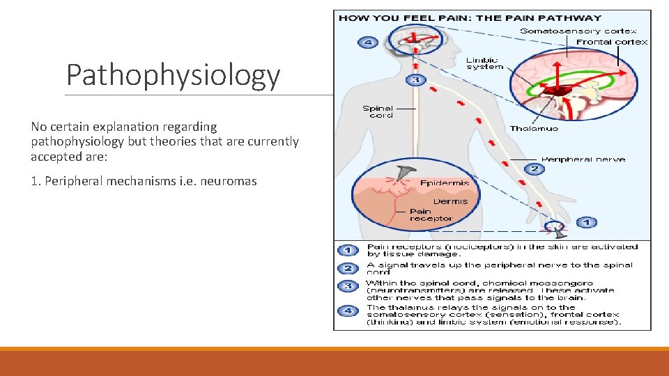 Pathophysiology No certain explanation regarding pathophysiology but theories that are currently accepted are: 1.