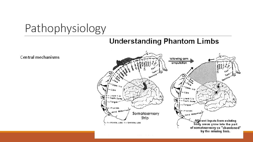 Pathophysiology Central mechanisms 2. Central mechanisms 