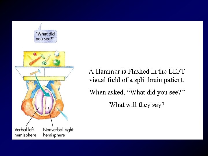 A Hammer is Flashed in the LEFT visual field of a split brain patient.