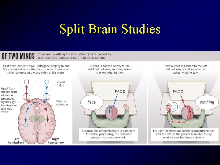 Split Brain Studies 