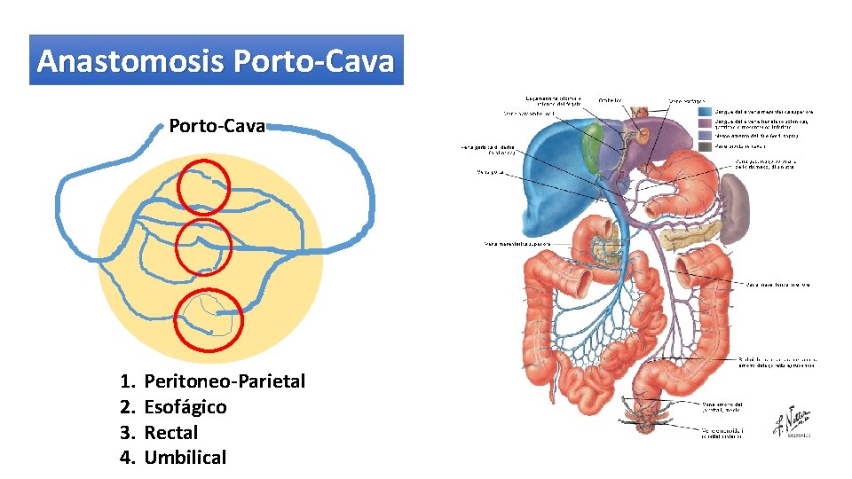 Anastomosis Porto-Cava 1. 2. 3. 4. Peritoneo-Parietal Esofágico Rectal Umbilical 