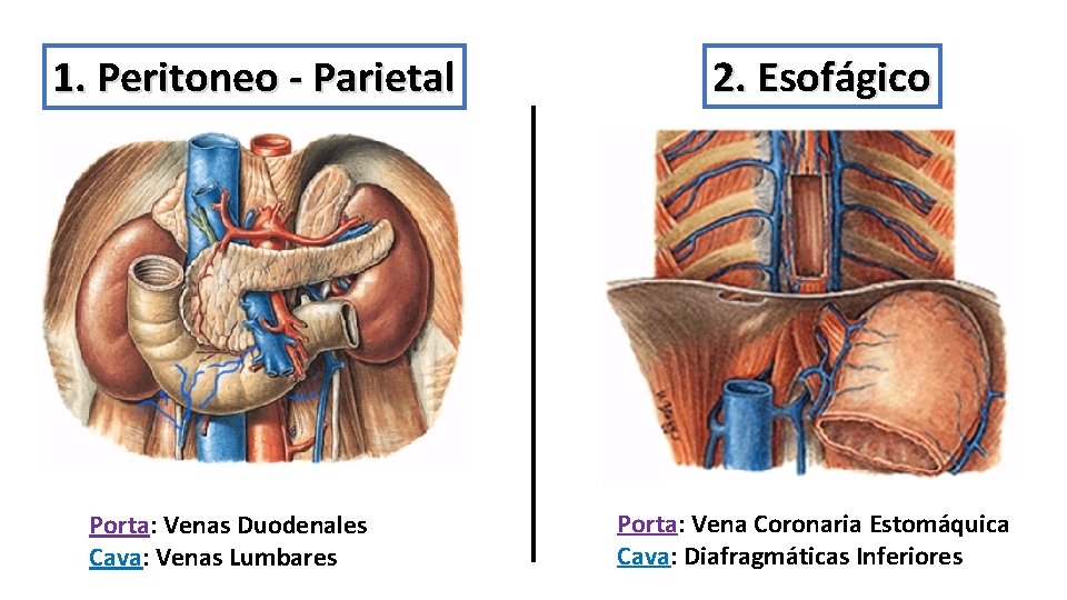 1. Peritoneo - Parietal Porta: Venas Duodenales Cava: Venas Lumbares 2. Esofágico Porta: Vena