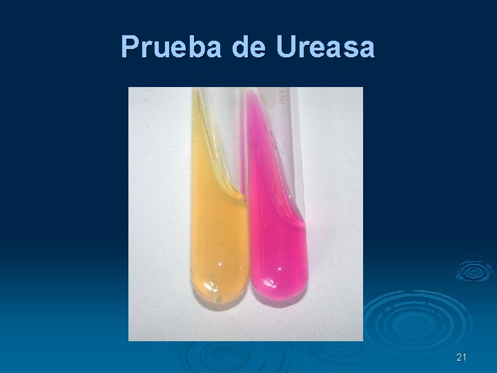 Prueba de Ureasa 21 