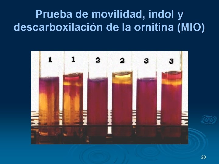 Prueba de movilidad, indol y descarboxilación de la ornitina (MIO) 23 