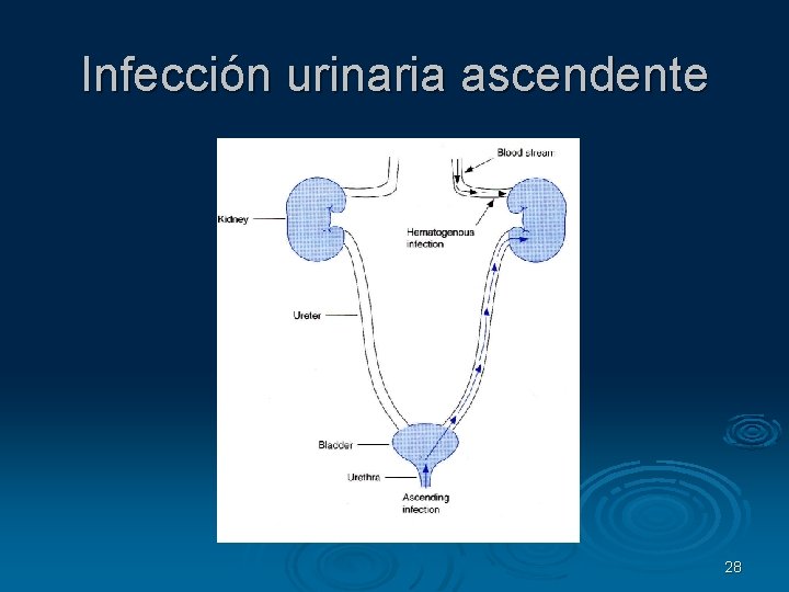 Infección urinaria ascendente 28 