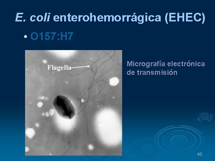 E. coli enterohemorrágica (EHEC) • O 157: H 7 Flagella Micrografía electrónica de transmisión