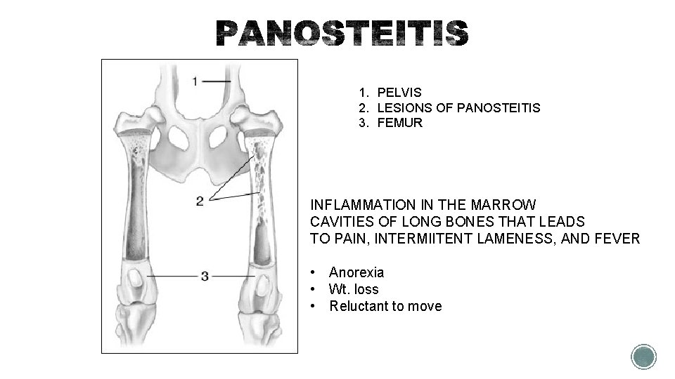 1. PELVIS 2. LESIONS OF PANOSTEITIS 3. FEMUR INFLAMMATION IN THE MARROW CAVITIES OF
