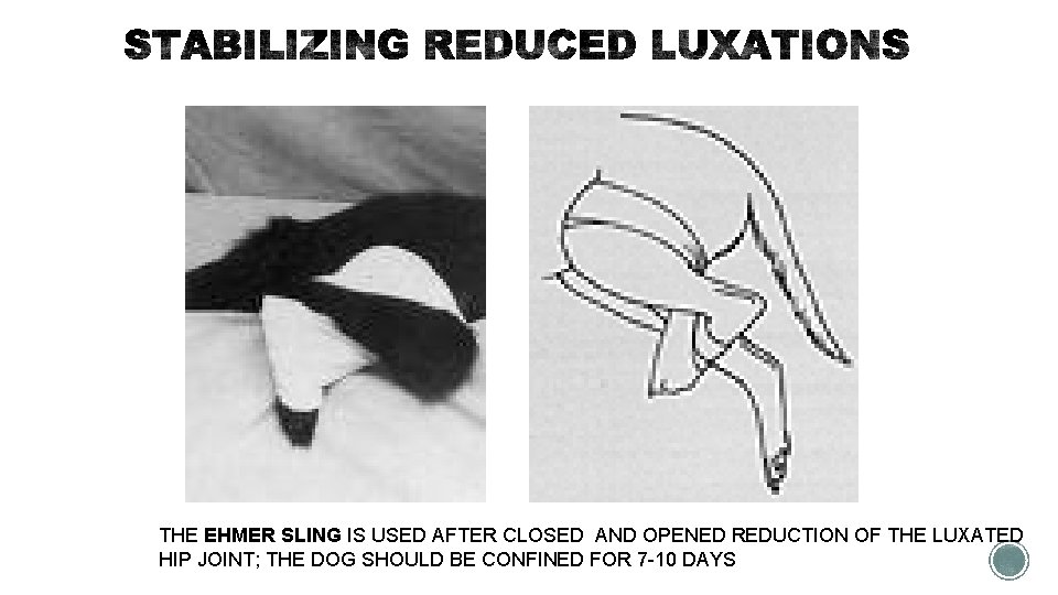 THE EHMER SLING IS USED AFTER CLOSED AND OPENED REDUCTION OF THE LUXATED HIP