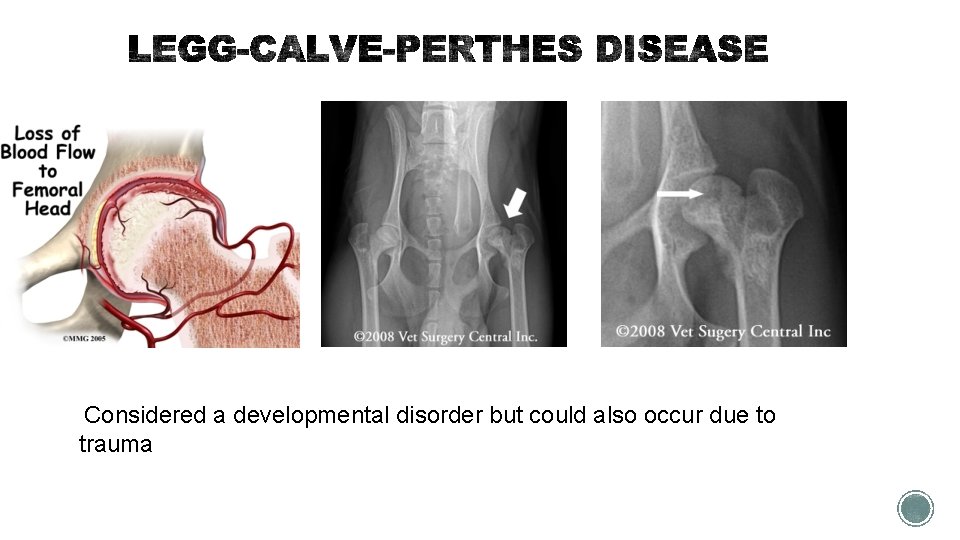 Considered a developmental disorder but could also occur due to trauma 