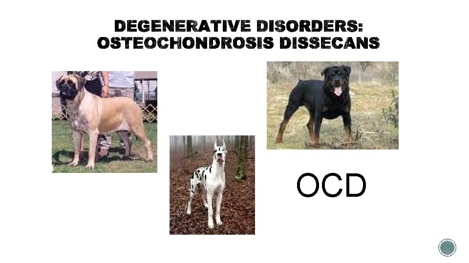 OCD 