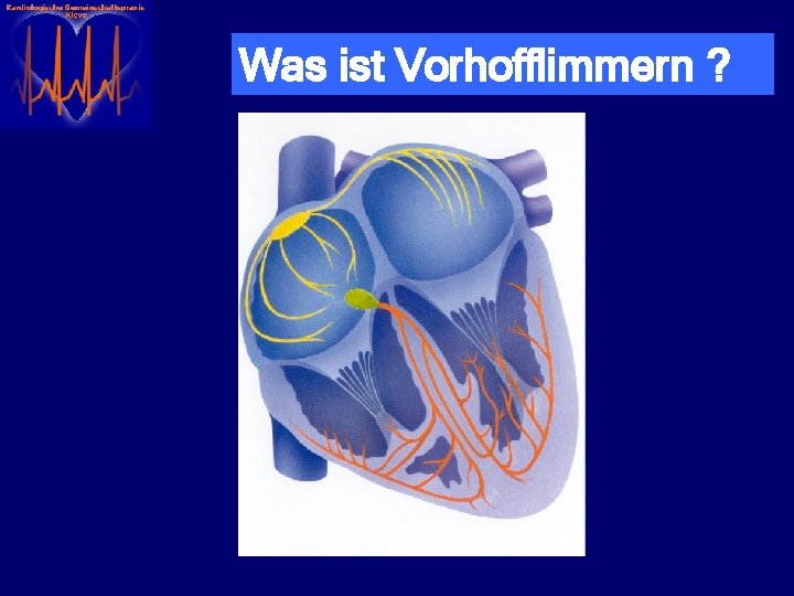 Absolute Arrhythmie bei Vorhofflimmern H Meien Beispiele aus