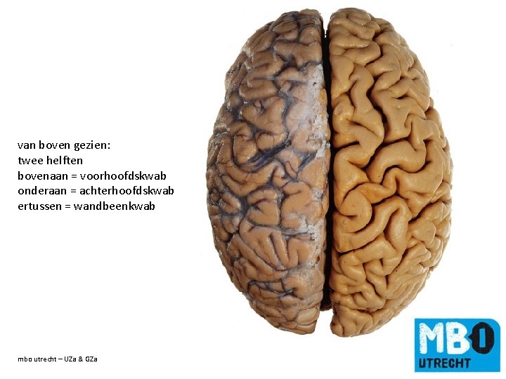van boven gezien: twee helften bovenaan = voorhoofdskwab onderaan = achterhoofdskwab ertussen = wandbeenkwab