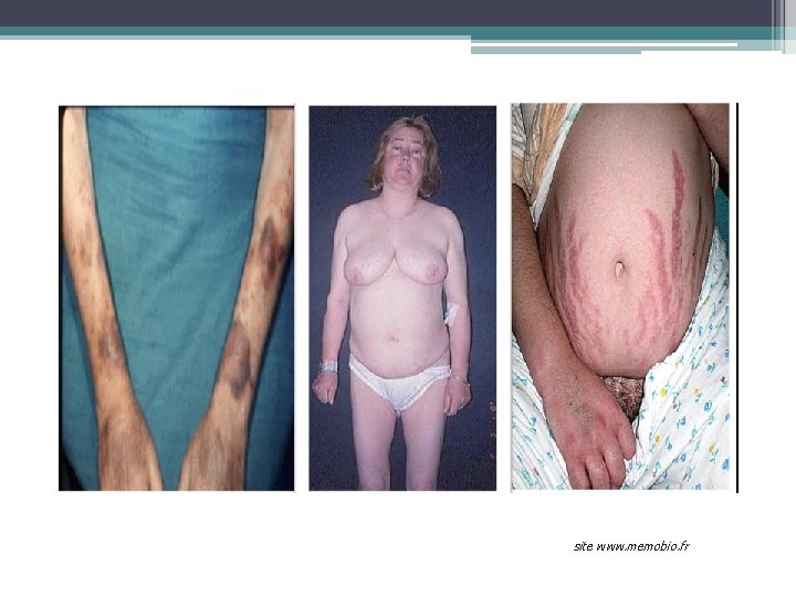 site www. memobio. fr 