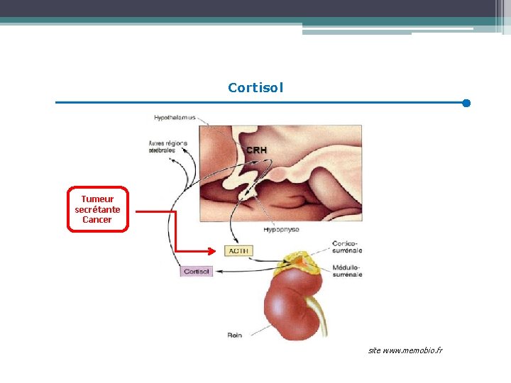 Cortisol Tumeur secrétante Cancer site www. memobio. fr 