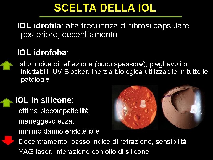 SCELTA DELLA IOL idrofila: alta frequenza di fibrosi capsulare posteriore, decentramento IOL idrofoba: alto