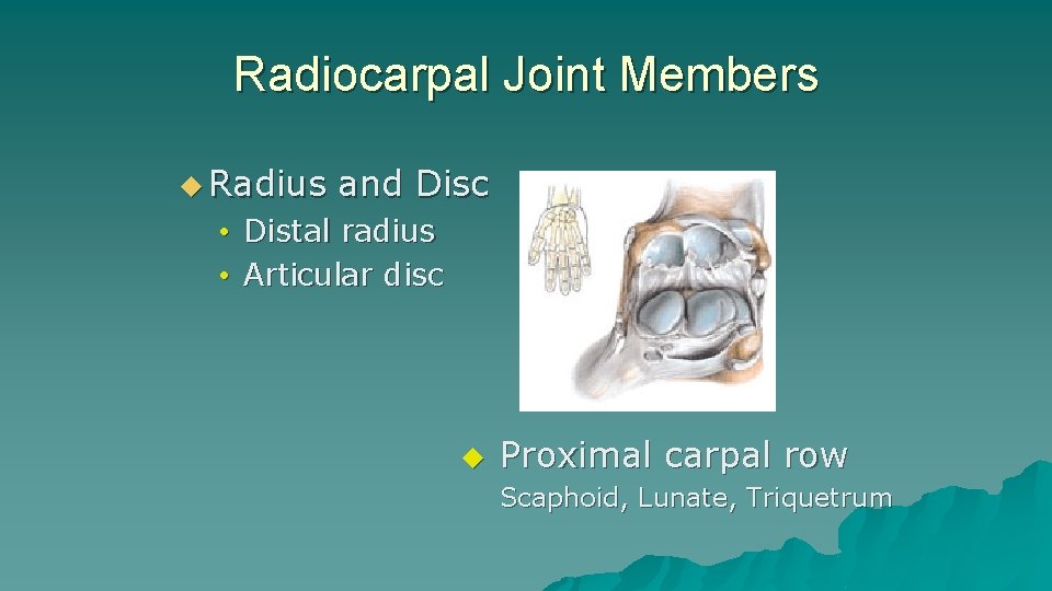 Radiocarpal Joint Members u Radius and Disc • Distal radius • Articular disc u Radiocarpal Joint Members u Radius and Disc • Distal radius • Articular disc u