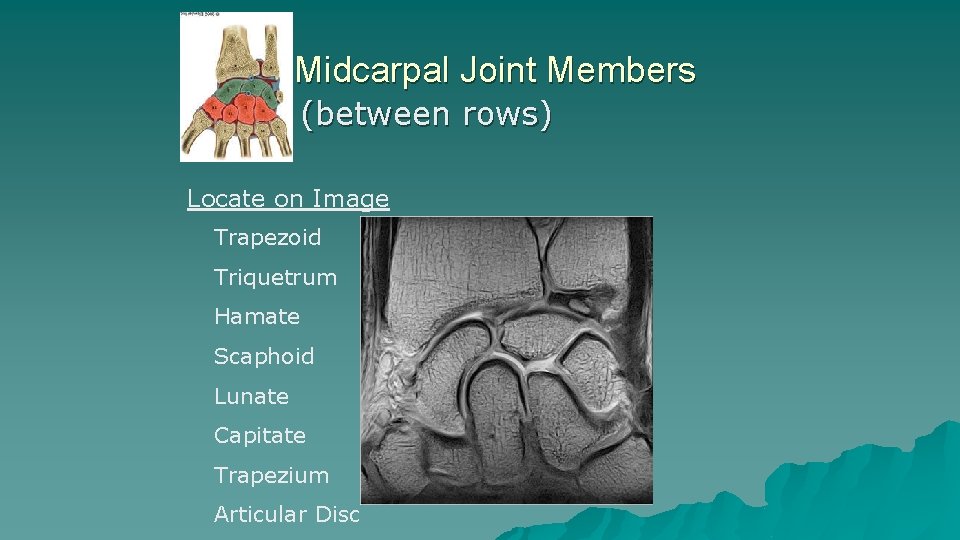 Midcarpal Joint Members (between rows) Locate on Image Trapezoid Triquetrum Hamate Scaphoid Lunate Capitate Midcarpal Joint Members (between rows) Locate on Image Trapezoid Triquetrum Hamate Scaphoid Lunate Capitate