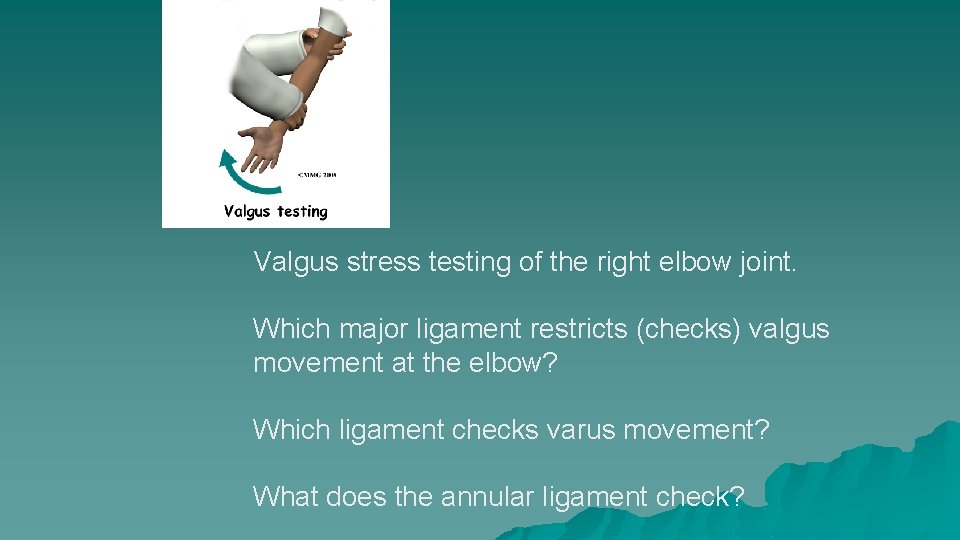Valgus stress testing of the right elbow joint. Which major ligament restricts (checks) valgus Valgus stress testing of the right elbow joint. Which major ligament restricts (checks) valgus