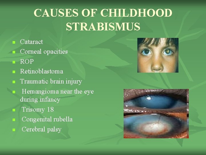 CAUSES OF CHILDHOOD STRABISMUS n n n n n Cataract Corneal opacities ROP Retinoblastoma
