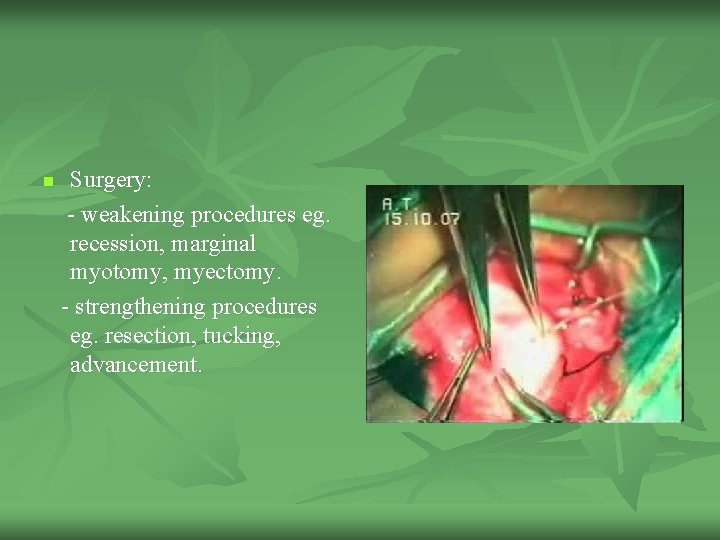 n Surgery: - weakening procedures eg. recession, marginal myotomy, myectomy. - strengthening procedures eg.