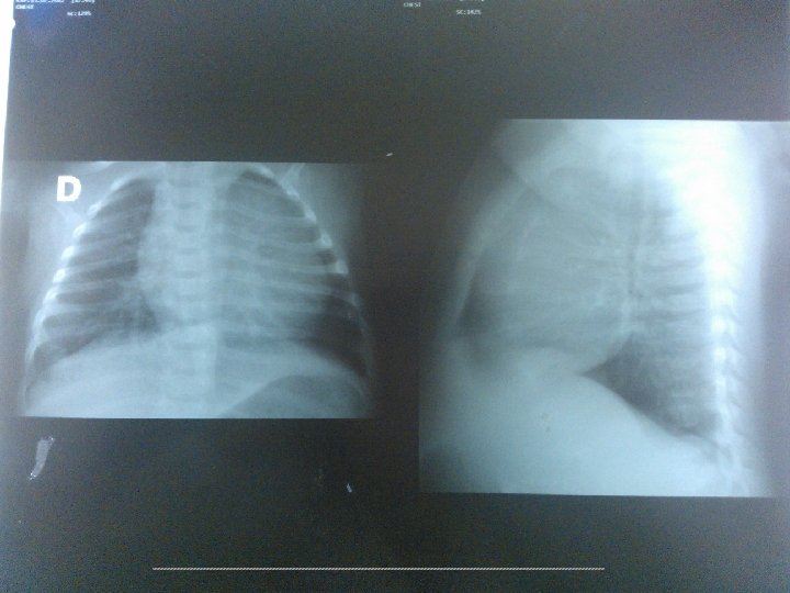 Primeira radiografia (13/07/12) 2/20/2021 11 