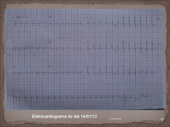 Eletrocardiograma (14/07/12) Eletrocardiograma do dia 14/07/12 2/20/2021 13 