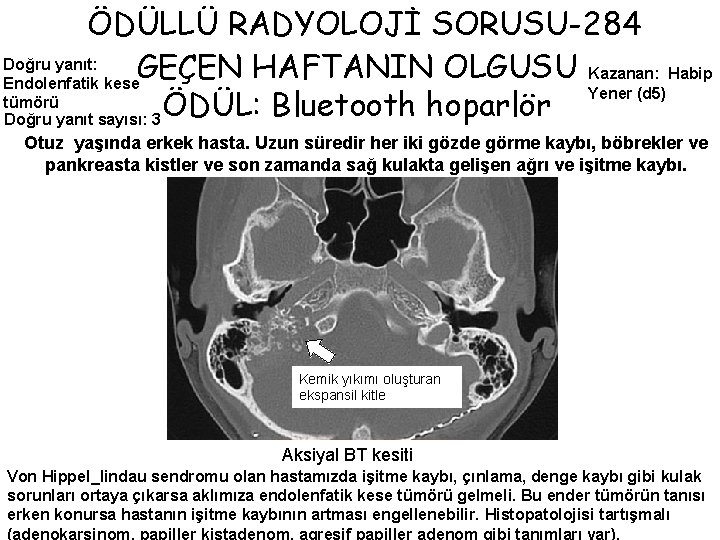 ÖDÜLLÜ RADYOLOJİ SORUSU-284 Doğru yanıt: GEÇEN HAFTANIN OLGUSU Kazanan: Habip Endolenfatik kese Yener (d