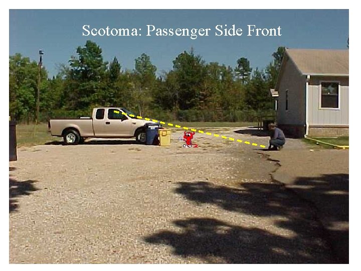 Scotoma: Passenger Side Front 