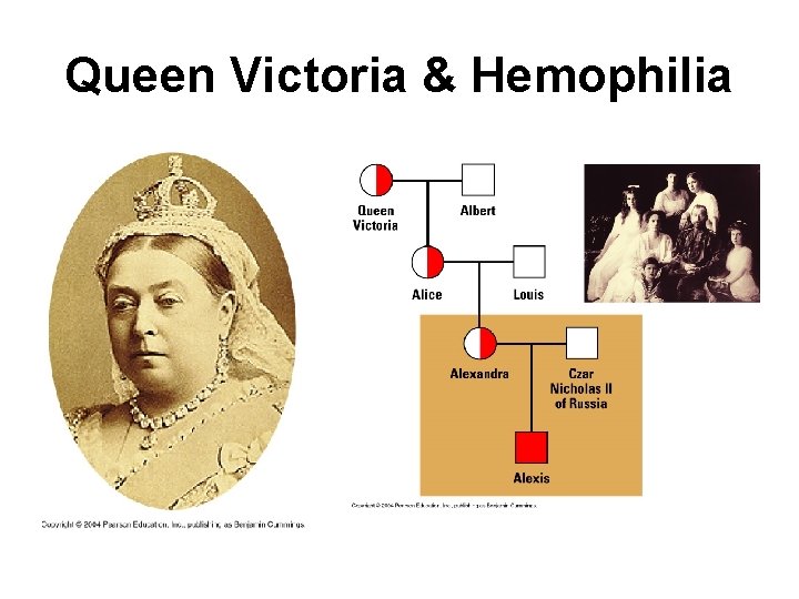 Queen Victoria & Hemophilia 