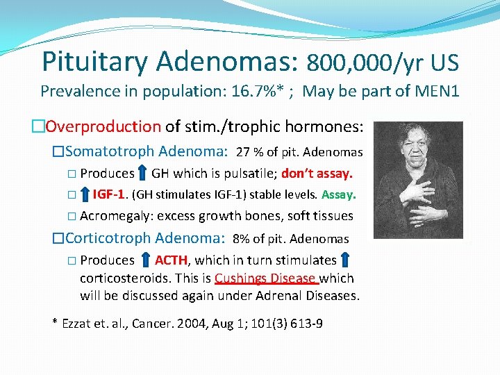 Pituitary Adenomas: 800, 000/yr US Prevalence in population: 16. 7%* ; May be part