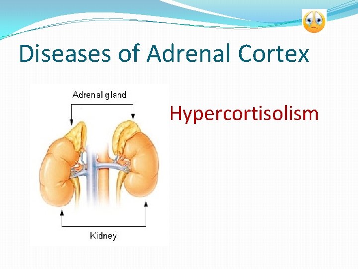 Diseases of Adrenal Cortex Hypercortisolism 