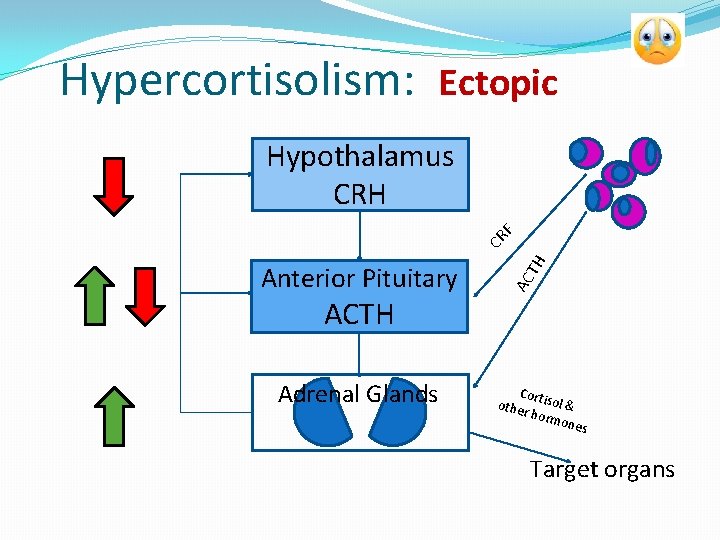 Hypercortisolism: Ectopic AC Anterior Pituitary TH CR F Hypothalamus CRH ACTH Adrenal Glands Cor