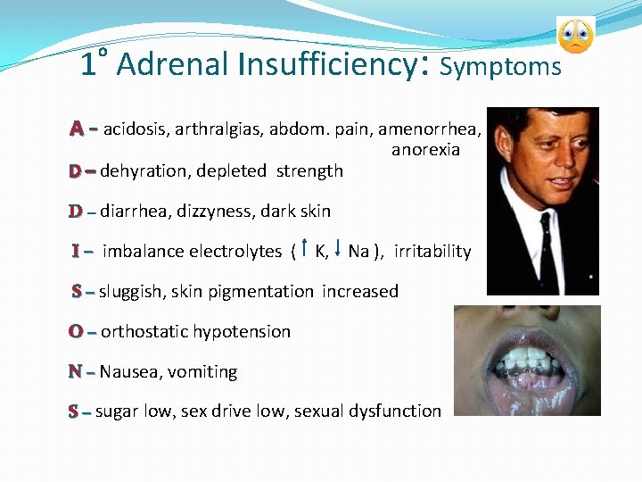 1 Adrenal Insufficiency: Symptoms o A - acidosis, arthralgias, abdom. pain, amenorrhea, D –