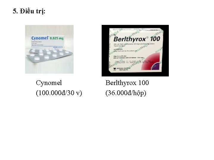 5. Điều trị: Cynomel (100. 000đ/30 v) Berlthyrox 100 (36. 000đ/hộp) 